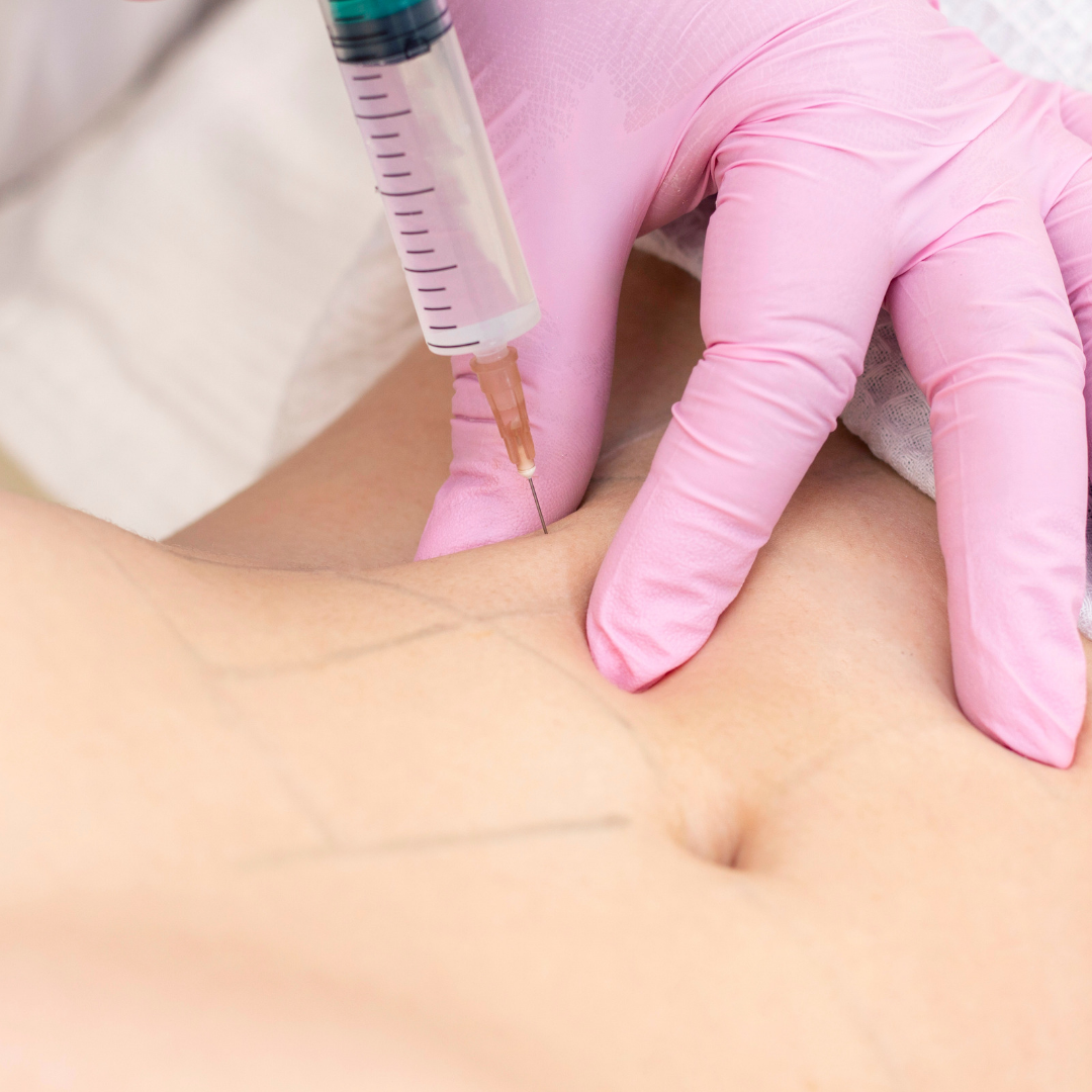 The New Weight Loss Phenomenon: Semaglutide Injections and the Need for Skin Tightening