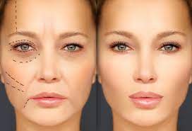 Illusion of Perfection in Cosmetic Surgery